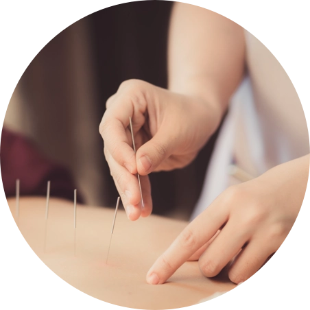 Santé Agile — Découvrez nos soins de médecine intégrative chinoise 